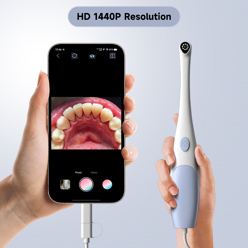 Caméra endoscopique orale 1440 - Macro Photography Led Lighting avis et prix