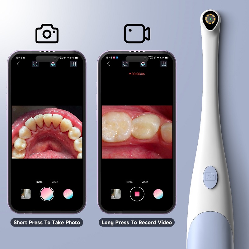 Caméra endoscopique orale 1440 - Macro Photography Led Lighting avis et prix